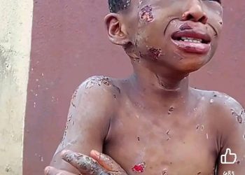 Chiziterem: Woman Brutalized Boy In Anambra (viewer’s Discretion)