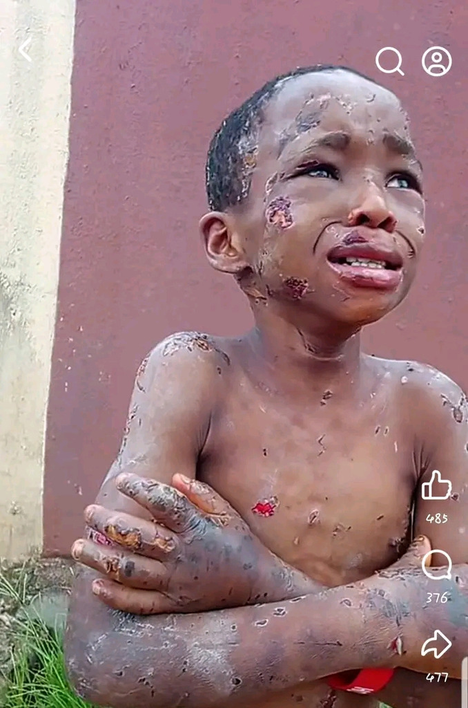 Chiziterem: Woman Brutalized Boy In Anambra (viewer's Discretion) 2 19991171 1781446575345 jpeg8405a9930dc56893ebc4491a50c9039f