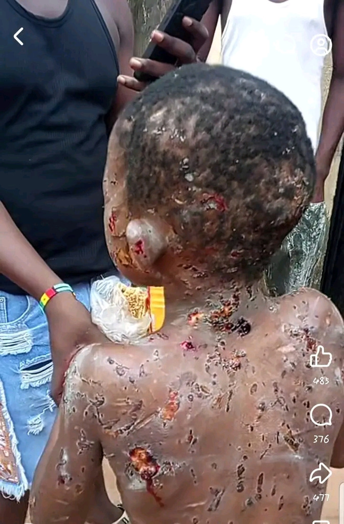 Chiziterem: Woman Brutalized Boy In Anambra (viewer's Discretion) 1 19991173 1781446581206 jpeg6200f6414dea6a21b7f7bb222c197b85