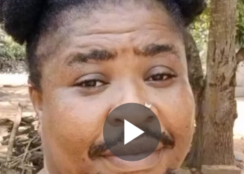 VIDEO: I’m a woman but i …… Lady reveals Hirsutism condition